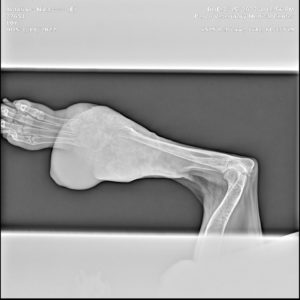 X-ray of Nina's primary Osteosarcoma in dogs tumor, 22 months after diagnosis of canine osteosarcoma