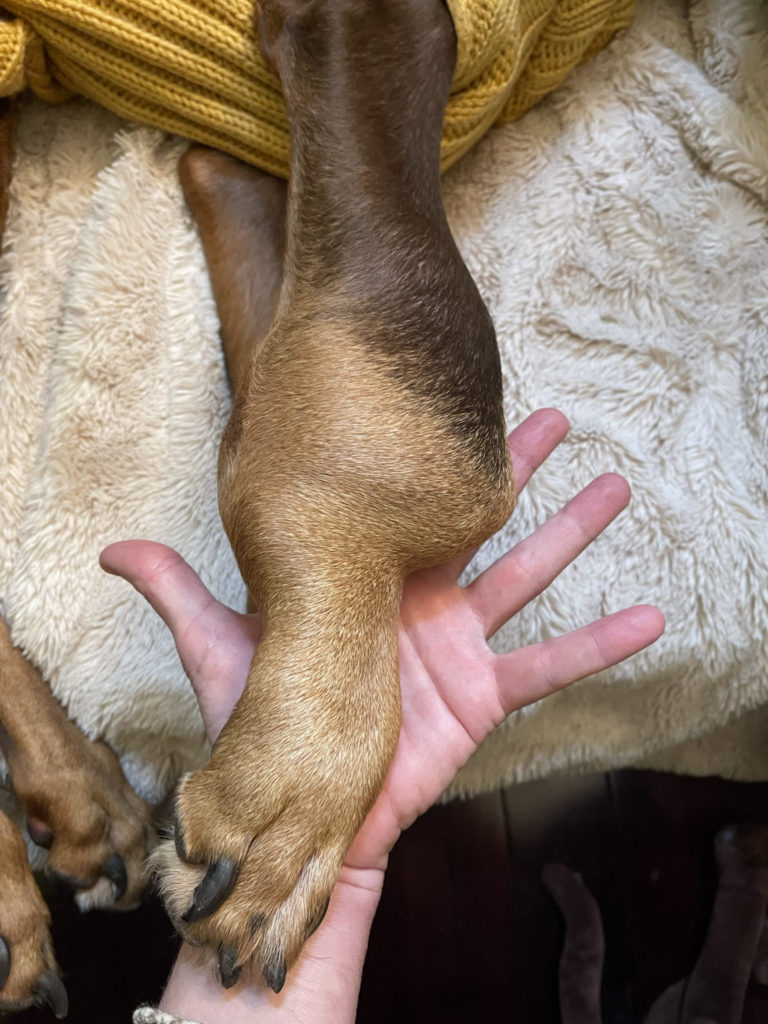 Nina Osteosarcoma tumor leg, size comparison to hand 